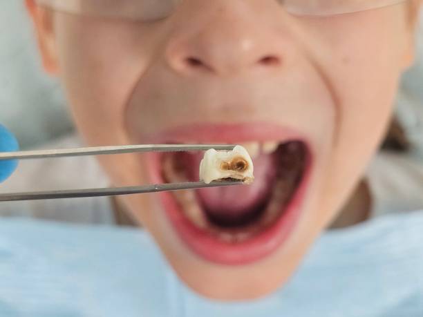 Best Emergency Cosmetic Dentistry (e.g., broken veneers) in Wells Branch, TX